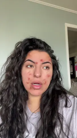 Not the filter moving everywhere 