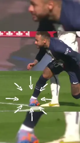 What is ankle sprain ? Ankle sprain is a common injury that occurs when the ligaments in the ankle are stretched or torn. This usually happens when the ankle is twisted or turned in an awkward way, causing the ligaments to overstretch. Ankle sprains can range from mild to severe, and symptoms may include pain, swelling, bruising, stiffness, and difficulty bearing weight or walking. #neymar #neymarjr #neymarinjury #anklesprain #anklesprains #anklesprainrehab #physicaltherapy #physiotherapist #physiotherapy #physicaltherapist #anklepain #anklepainrelief #anklepaintreatment #UnlimitedHPInk 