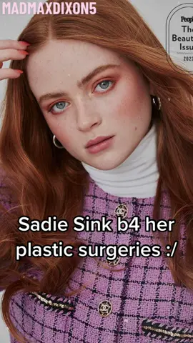 Sadie before her plastic surgeries :/ #sadiesinkedit #sadiesink #maxmayfield #strangerthings #fearstreet #thewhale #netflix #trends #fyp 