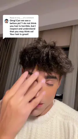 Replying to @izzy___iz HAIRLINE REVEAL! This is my before. My #hairtransplant is tomorrow with @nowhairtime 😬 SUPER NERVOUS!!! Wish me luck 🤞🏼 #nowhairtime #hairtransplantturkey 