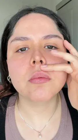 Último #update ✨👍🏼 #lipfiller #rellenodelabios #lipfillercheck #mujeres #latinas 