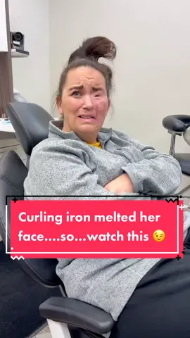 Curling iron melted her face…after an epileptic seizure….so I wanted to help her feel beautiful again. #freak #accident #epilepsy #smile #again #fyp I would love anyone who knows a plastic surgeon qualified to help Brittney, to please reach out to me so we can give her back even more. Thank you 