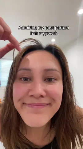 I left my treadmill to do this a million times. IB: @gems_evansx #postpartumhairloss #postpartumworkout #momtok #momtiktok #twinmom #postpartumhairgrowth #hairliss #momcontent #momcreator 