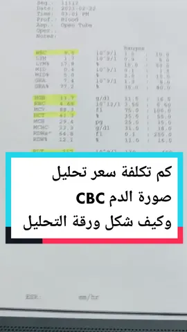 Replying to @authentic271 رجاءا لا تصدكون أي تعليق مبالغ بي 💯 #foryoupage #fyp #مشاهير_تيك_توك #مختبرات_طبية #كركوك #ممرضين_العراق 