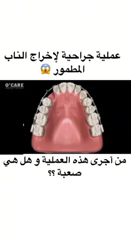 #surgery #chirurgie #operation #esthetic #astuce 