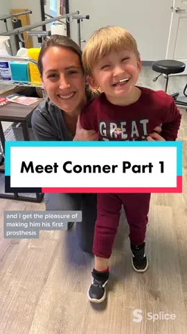Meet Conner: Part 1 🥰 #prosthetic #amputeelife #amputeetiktok #workmodetiktok #amputeekids #casting #toughkids #workmodetiktok  @boy.mama.17 