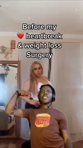 #mishellitah #ptp #fyp #weightloss #vsgbeforeandafter #sleeve #antesydespues #plasticsurgery #trending #conMishellitah #tupelirojafavorita  Super vulnerable post but here is a quick little before and after my weight loss surgery. -90lbs🙌🏻 #sisepuede  