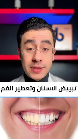 تبييض الاسنان وتعطير الفم #دكتور_محمود 