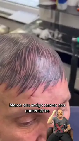 Marca seu amigo careca ae nós comentários #funny #fyp #explorepage✨ #explorepage 