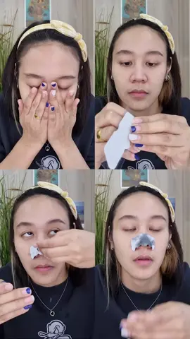 ใช้ผิดวิธี ลอกยังไงก็ไม่ออก 🥹😂 #TheOriginal #ลอกสิวเสี้ยน 