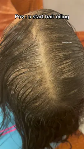 Before and after its magical 🙏🏽😍 #hairoiling #hairgrowth #hairfall #hairtok #fyp #viral #hairtransformation 