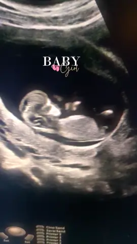 Did you know baby moves this much at 11 weeks? #11weekspregnant  #11weeks #pregnantmama #preg #ultrasound #babygirl #2dultrasound #baby #pregnanttiktok #mommabear #mommytobe #firsttimemommy 