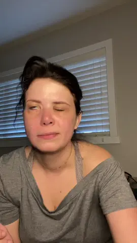 Happy #FacialPalsyAwarenessWeek❤️ #FaceEquality #FacialPalsy #FacialParalysis #EmbraceYourFace #TreatMeRight #NotAJoke #NotAVillian #DoBetter 