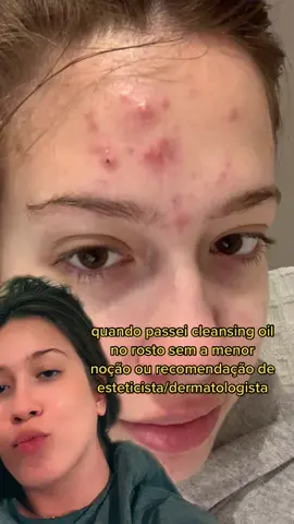 mais uma saga do skin care pra vcs meus amigos e amigas #skin #skincare #cleansingoil #skintok #fypシ 