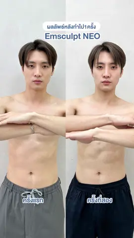 ทำครั้งที่ 2 กล้ามขึ้นชัดขนาดนี้เลย! Emsculpt NEO ทดลองทำจุดละ 5,500 พุ่งตัวมาเลยที่ #เดอะคลีนิกค์ #theklinique #รีวิวบิวตี้ #มีนพีรวิชญ์