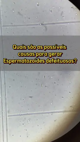 Hoje vamos abordar AS CAUSAS DA INFERTILIDADE MASCULINA. Assista ate o final para saber inclusive os principais tratamentos. #infertility #infertilecouple #infertileontiktok #infertilidademasculina #infertilidade #couple #esperma #defeito #anomaly #anomaliagenetica #bebe #babylove #babyshark #futebol #futebolbrasileiro #futebolmuleke #peladachallenge #bolada #moto #motorcycle #obesidade #obesidad #estresse #anabolizantes #academia #maromba #muscle #muscleschallenge #quimicos #agrotoxicos #agrotop #agroboy #ist #biomedicina #biologia #tecnicoanalisesclinicas #analisesclinicas #exame #examenes #diadasmulheres 