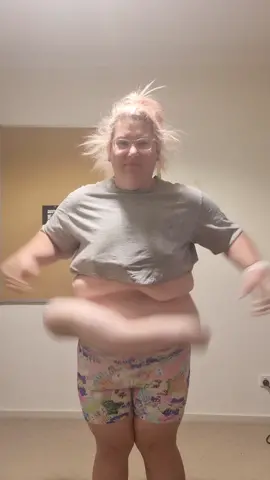 3 weeks post  tape came off today, 3 more weeks of bed rest  #timbrownplasticsurgeon #excessskinremoval #postwls #plasticsurgery #fluerdelysabdominoplasty #skinfluencer #fdl 