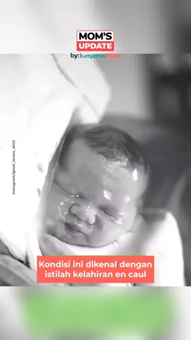 Normalnya, bayi lahir setelah ketuban pecah. Namun, dalam kasus yang sangat langka, bayi bisa terlahir dengan kondisi masih di dalam kantung ketuban yang utuh atau dikenal dengan istilah kelahiran en caul. Yuk, pahami lebih lanjut soal fenomena bayi lahir masih terbungkus kantung ketuban lewat video di atas, Moms. #momsupdate #update #mom #svl #bayi #kelahiran #ketuban #ibu #PerempuanBisa 