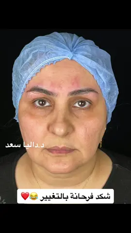 #اكسبلور #تيك_توك #محتوى #فلر  #حقن  #مراكز_تجميل  #تغيير_شامل #دكتورة 