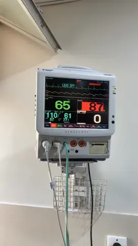 #ventilator #caridiac_monitor #caridiac_monitor #icu #life_is_short #Dr #hospital #medico 