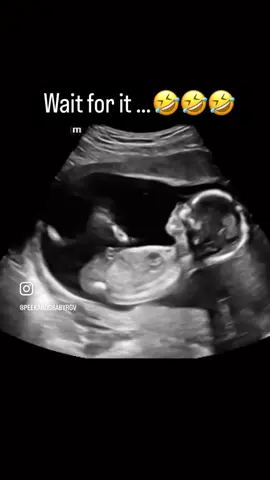 If this is your baby, drop a 🖐🏼 in the comments!! 🤣  These babies be wild in there! 🤣🤣🤣 15 weeks 5 days, and baby girl is 💃🏻💃🏻💃🏻 #baby #sonogram #Lifestyle #pregnant #babybumps #pregnancy #babygirl #itsagirl #reels #reelsinstagram #reelsvideo #pregnancyannouncement #pregnantbelly #reelsviral