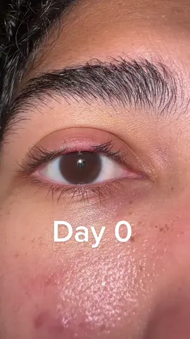 Back to day 0…. Just pulled out about 10 lashes and couldnt stop. #trichotillomania #trillotrichomania #eyelashes #mentalhealthmatters #ocd #anxiety 
