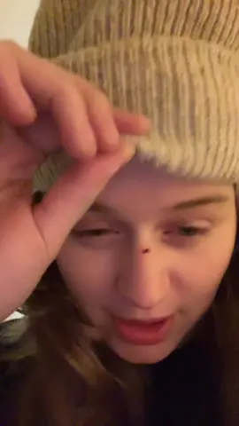 did i tell you about my snowboarding accident