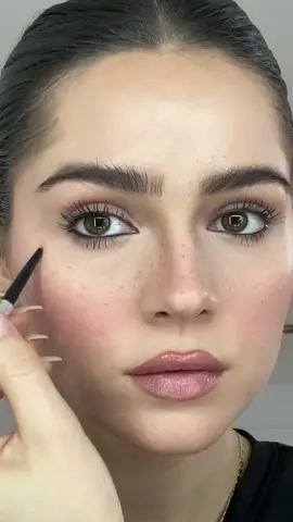 #freckles 