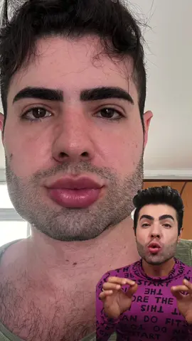 VOCÊS JÁ CONHECIAM ESSA CIRURGIA? 😳 Eu nunca tinha ouvido falar nela e quando me deparei com as postagens do @Dr. Jorge Fernandes  corri para entender mais sobre o assunto, até que tomei a decisão de realizar e registrar tudo para vocês, já que não existe nenhum conteúdo de paciente abordando o assunto. ▪️ Quer informações extremamente detalhadas sobre todo o processo? Link na bio. Hashtags: #ImplantedeMandibula #Harmonizacao #HarmonizacaoFacial #HarmonizaçãoFacial #Estetica #Bichectomia #ImplantedePolietileno