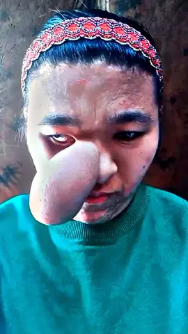 God bless her 🙏🙏🙏#disabillities #handicapped #strangedisease #disease #life #foryou #virla #trendtiktok #fypシ #fyp #fypシ゚viral 