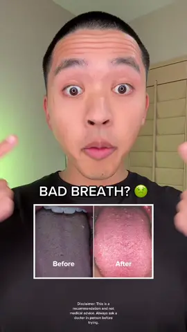 Drink 2L water daily for BETTER RESULTS 🤯 #foryou #fyp #insecure #badbreath #stinky #greenscreen 