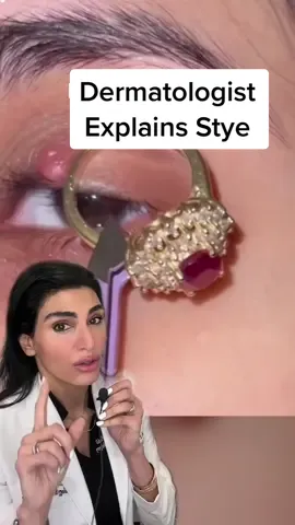 Gold therapy for #stye ? @pcos_babe #styetreatment #LearnOnTikTok #medical #skinbydrazi    