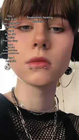 AHHHH Healing process for almost a whole week!! It's going gooooodd!! #alt #downtowngirl #rockstargirlfriend #piercing #snakebitepiercings #10piercingstotal #painfulpiercing #snakebite #piercinghealingprocess #healingprocess 