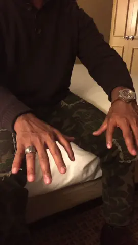 Ever seen a normal 6 fingered hand? Meet my dad 🤣🤍 #polydactyl #polydactly #6fingers #nonubs #viral #viralvideo #dadsoftiktok #fatherdaughter #dad #polydactylyguy 