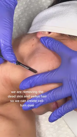 Replying to @ey_nourya some people think its just a face shave….but its so much more than that! The benefits are anti-aging + you’ll have the glowiest skin! ✨ #dermaplaning #dallasmedspa #estheticiantiktok #facialasmr #skincareasmr #asmr 