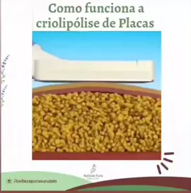 #criolipolise  #criolipolisedeplacas #criolipolisesurubim 