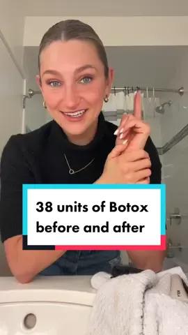 also you can get $25 off at The Fitz if you mention my name 🫡 #botox #medspa #chicago 