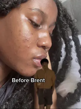 #EstalandoOsDedos Christopher took all my stress away😩 #brentfaiyaz #brent #clearskin #clearmakeup #smoothmakeup #makeup #smoothmakeupapplication #flawlessbase #basemakeup #capcut 
