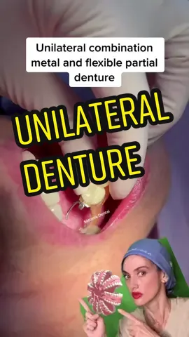 #unilateral #denture 🦷😁 #viral #teeth #dentes #dientes #diş #fyp #fypシ #parati #paravoce #seniniçin  #fypage #foryou #fy #dişhekimi 