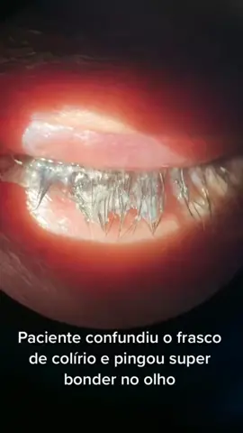 #costurar com @Dr João Victor Miranda Qual é o colírio certo🤔 #deficientevisual #pcd #curiosidade
