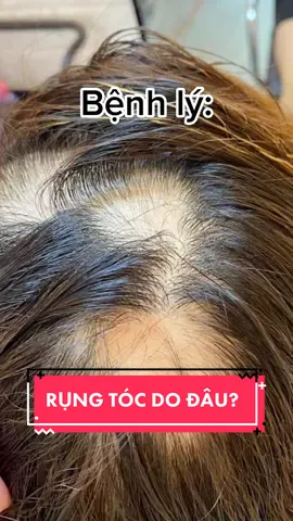 Trả lời @huyenzangzang2 rụng tóc do bệnh lý-sinh lý #duongtoc #rungtoc #rungtocsausinh #chamsoctoc #happipham #hairtok #hairloss #goclamdep #reviewlamdep #gdlfamily 