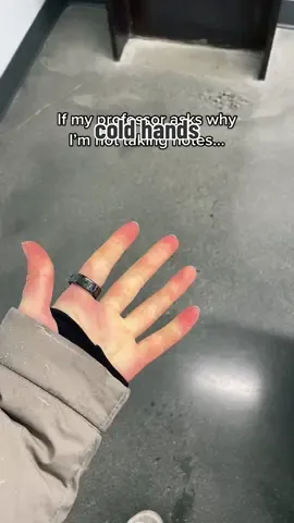 No circulation = robot fingers. Just raynauds things #raynauds #coldhands 