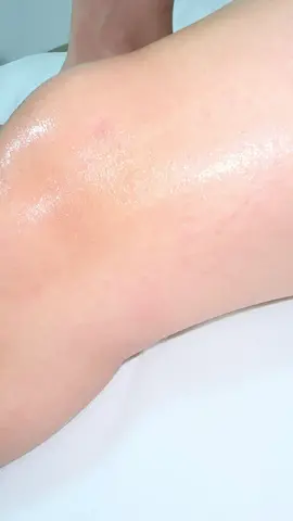 نعومة الجسم مع علاجات الليزر لازالة الشعر😍🔥 #النتائج من اول لقاءات👌🏻🔝