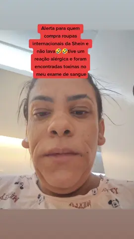 #shein  #elergia 