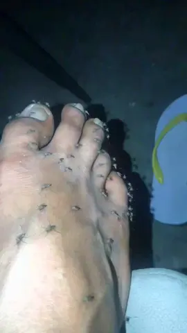 နွေရောက်တော့မယ် #myanmartiktok #ရယ်ချင်ဝင်ကြည့်သွား🤣🤣🤣 #fyp #ခြင်နော် #နွေရောက်ပြီ #mosquito #summervibes  #mandalay #yangon