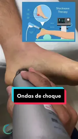 #fisio #fisioterapia #run #fasciite #crossfit #foot #pain #corrersemlesao 