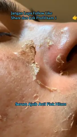 Serum ANTI FLEK HITAM #serumflek #serumantiflek #serumglowing #skincare #fyp #trending #viraltiktok #JurusJituGlowing #viral 