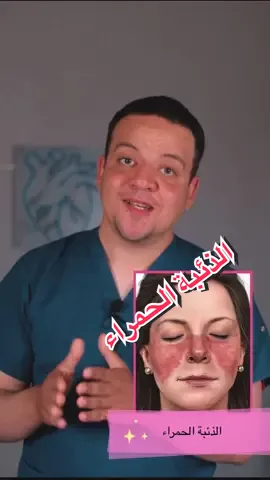 #الذئبة_الحمراء #دكتور_هوارى  #systemiclupuserythematosus  #مصر #ترند_السعودية @E L . H A W A R Y - الهوارى 