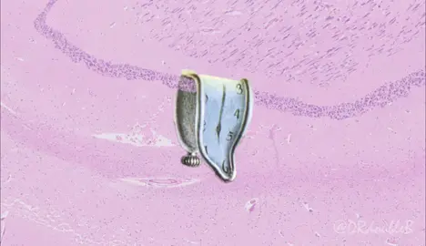 Persistence of Synapses #salvadordali #persistenceofmemory #pathology #pathologists #microscope #histology #slide #art #animatedart #neuroscience #brain #hippocampus #neuropath #neuro #synapse #pathart