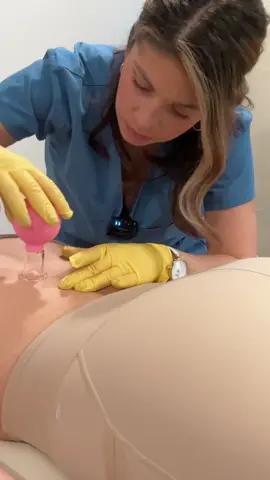 ASMR cupping that reduces nerve inflammation @ivybasmr #asmrchiropractic #asmrcupping #cuppingtherapy #cupping #cuppingmassage #cuppingmassagetherapy #asmrsensory #asmrdoctoraroleplay #asmr_tingles #asmrsleep #asmrmedical #asmrdoctor #asmrroleplay #asmrmedicalexam #asmrvideo #asmrsoftspoken #asmrmedicalroleplay #asmrvideo 
